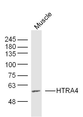HTRA4 antibody