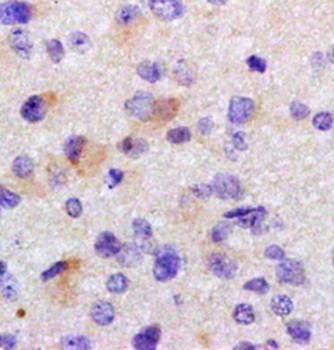 HuC Rabbit Polyclonal Antibody