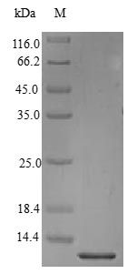 Human BTC protein (Active)