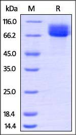Human CD117 Protein, His Tag