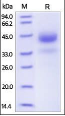 Human Cathepsin B / CTSB Protein