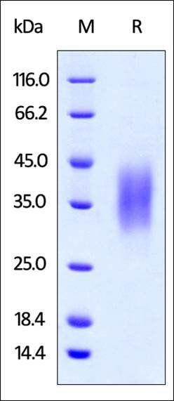 Human CD47 Protein, His Tag