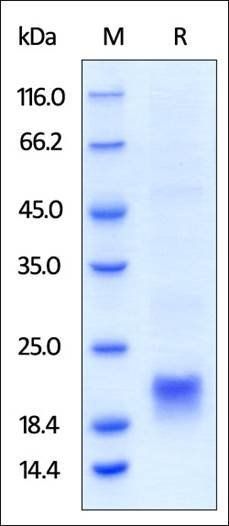 Human CTLA-4 Protein, His Tag