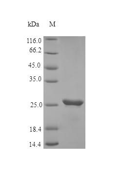 Human FGF23 protein (Active)
