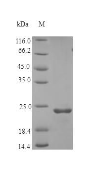 Human FGF9 protein (Active)
