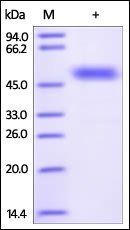 Human Frizzled-2 Protein, Fc Tag