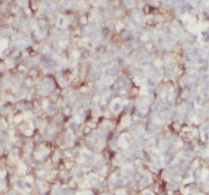 Mouse Anti-Human IgA Secondary Antibody