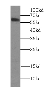 Mouse Anti-Human IgA Secondary Antibody