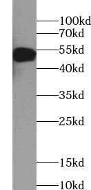 Rabbit Anti-Human IgG Secondary Antibody