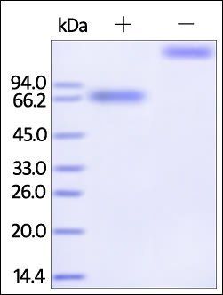 Human IL-21 R Protein, Fc Tag