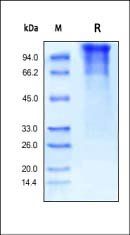 Human LDL R Protein, His Tag