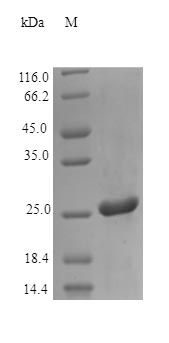 Human LEG3 protein (Active)