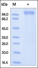 Human LRRC4 Protein, His Tag