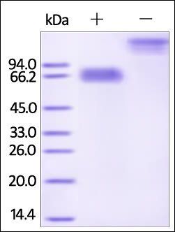Human Mesothelin Protein, Fc Tag