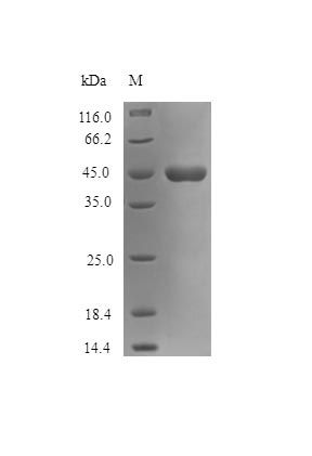 Human NEUS protein (Active)