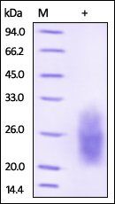 Human NKp30 Protein, His Tag