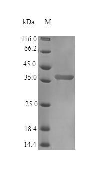 Human NOV protein (Active)
