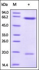 Human PCSK9 (D374Y) Protein