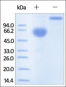 Human PROCR Protein, Fc Tag
