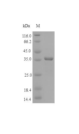 Human SPRC protein (Active)