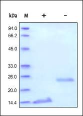 Human TGF-Beta 1 / TGFB1 Protein