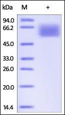 Human TGF-beta RII Protein, Fc Tag