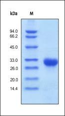 Human TIMP-1 Protein, His Tag