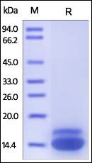 Human TRAIL R2 Protein, His Tag