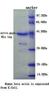 Human beta Actin protein