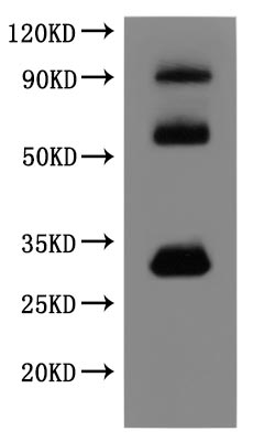 Human CLDN18.2 protein