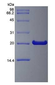 Human FGF 21 protein