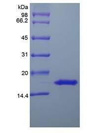 Human IL20 protein