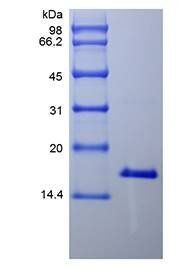 Human IL21 protein