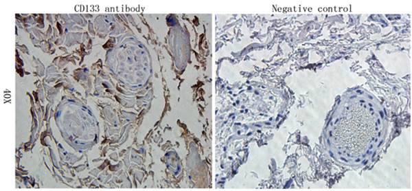 CD133 antibody