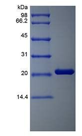 Human Oncostatin-M protein