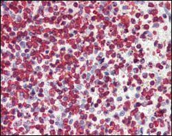 Human P16 Antibody