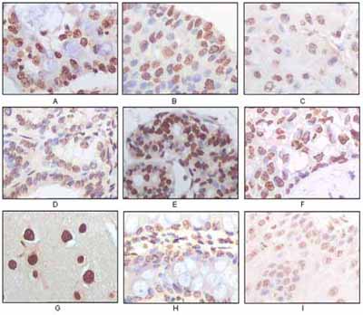 Human P16 Antibody