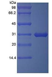 Human TIGAR-TAT protein