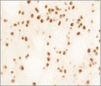 HTT Antibody