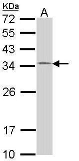 HUS1 antibody