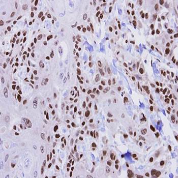 HUS1 antibody