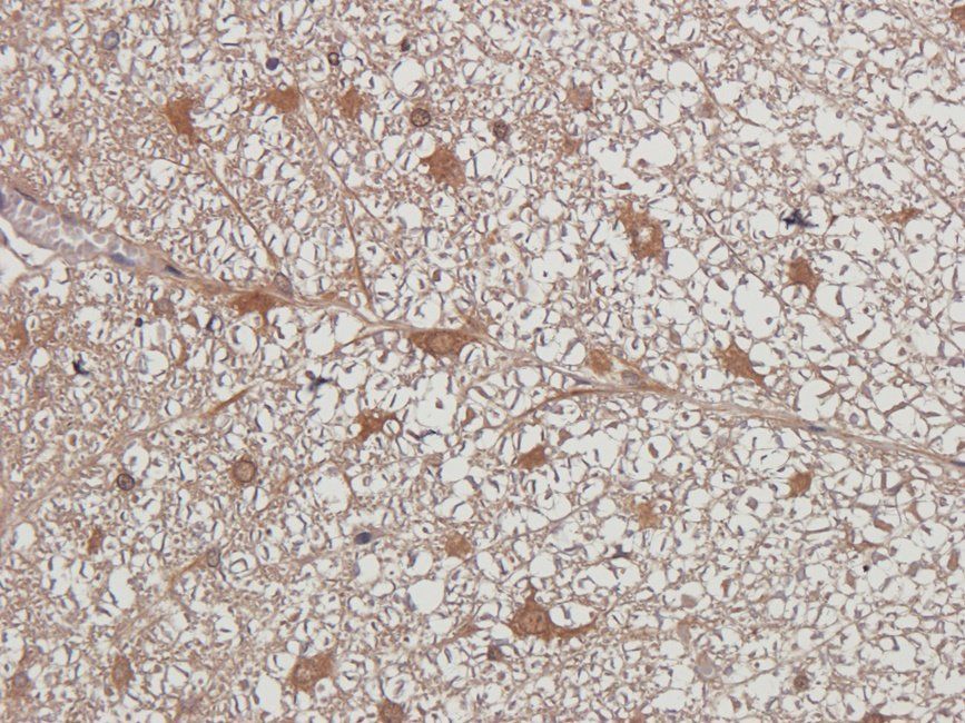 HXB2 antibody