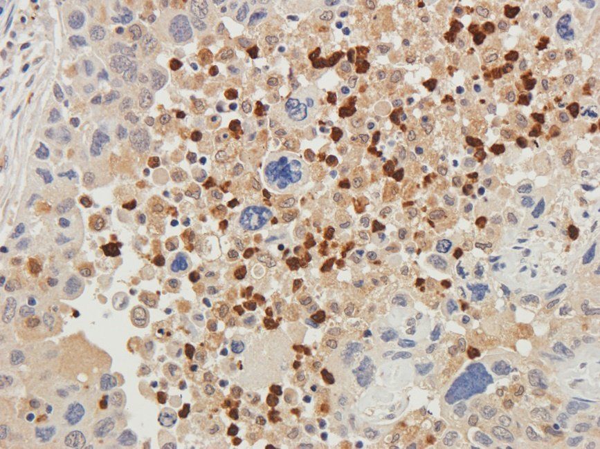 HXB2 antibody