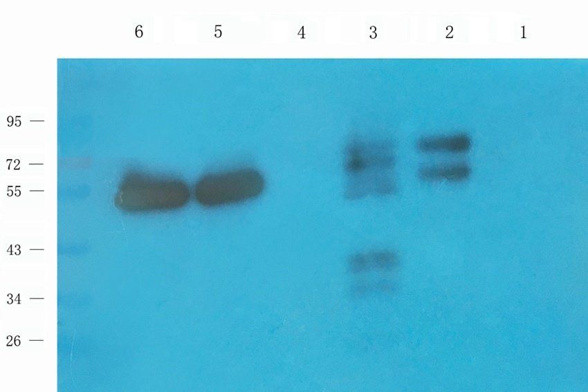 HXB2 antibody