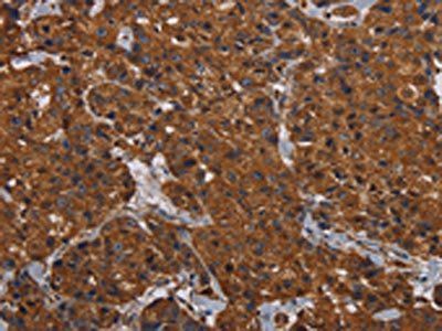 HYAL2 Antibody