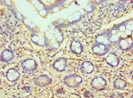 HYAL3 Antibody