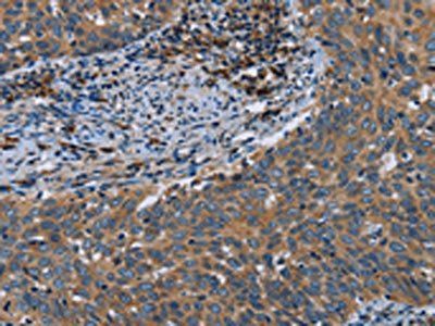 HYAL3 Antibody