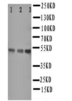 Hyaluronidase-3 HYAL3 Rabbit Polyclonal Antibody