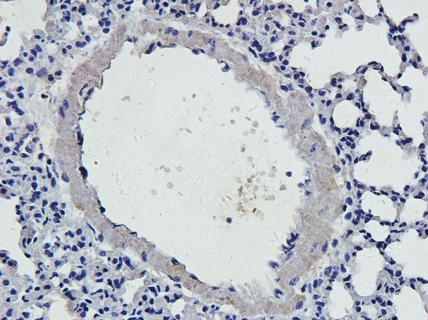 HYAS2 antibody