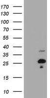 Hydroxysteroid (17 beta) Dehydrogenase 4 Antibody
